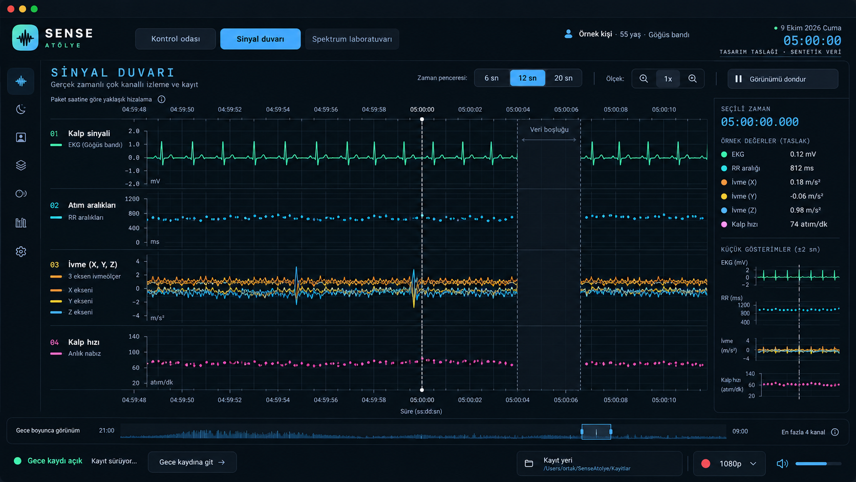 Sense Atölye Signal wall design draft with ECG, beat intervals, three-axis acceleration and heart rate on a shared time axis.